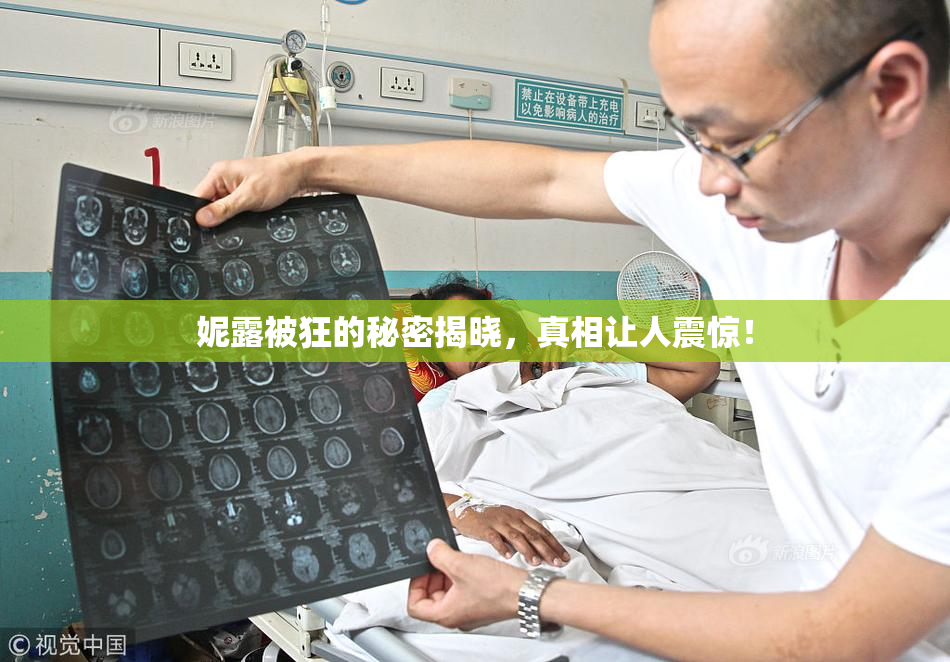 妮露被狂的秘密揭晓，真相让人震惊！