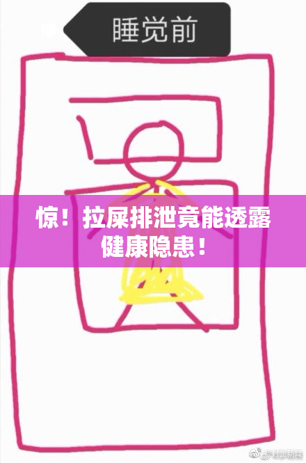 惊！拉屎排泄竟能透露健康隐患！