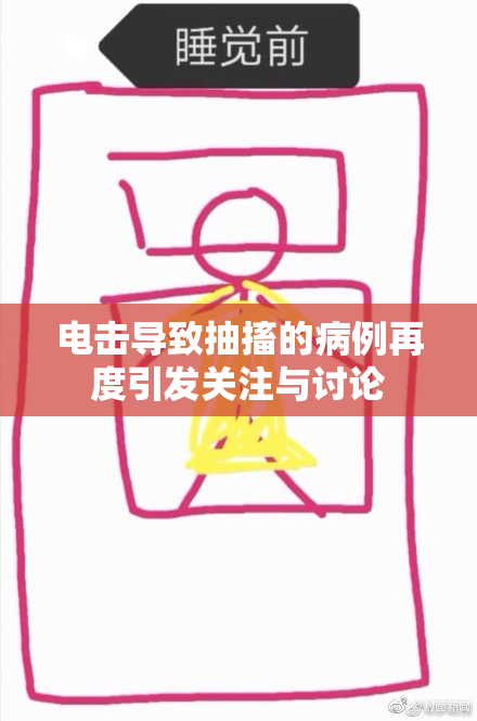 电击导致抽搐的病例再度引发关注与讨论
