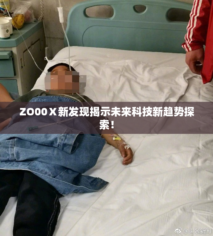 ZO00Ⅹ新发现揭示未来科技新趋势探索！