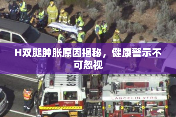 H双腿肿胀原因揭秘，健康警示不可忽视