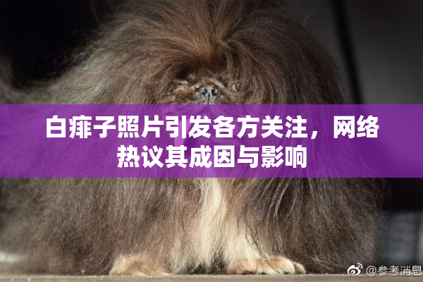 白痱子照片引发各方关注，网络热议其成因与影响