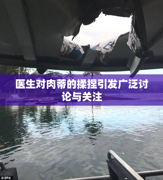医生对肉蒂的揉捏引发广泛讨论与关注
