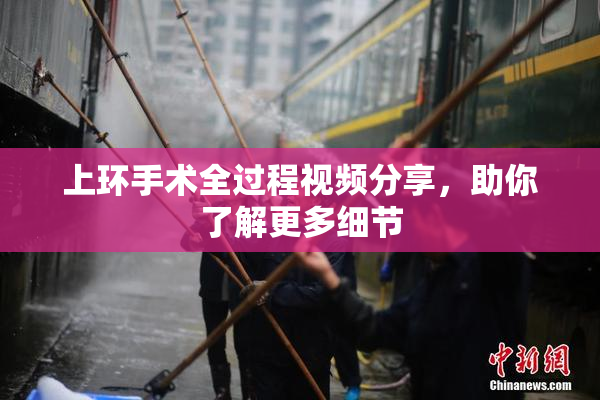 上环手术全过程视频分享，助你了解更多细节
