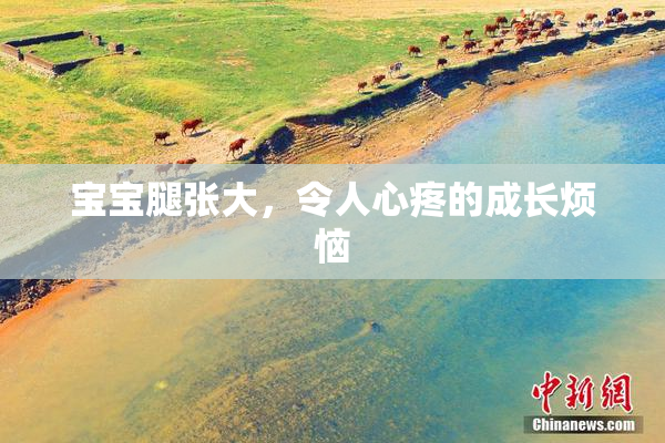 宝宝腿张大，令人心疼的成长烦恼