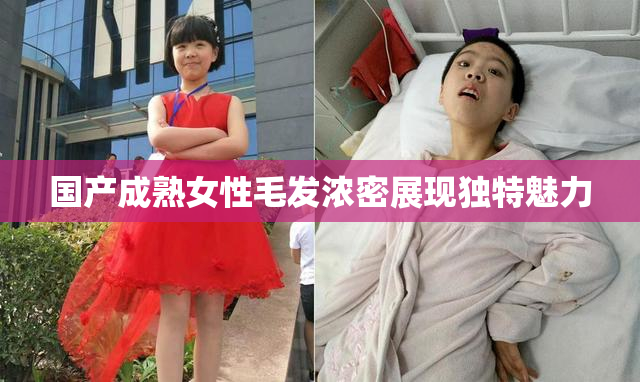 国产成熟女性毛发浓密展现独特魅力