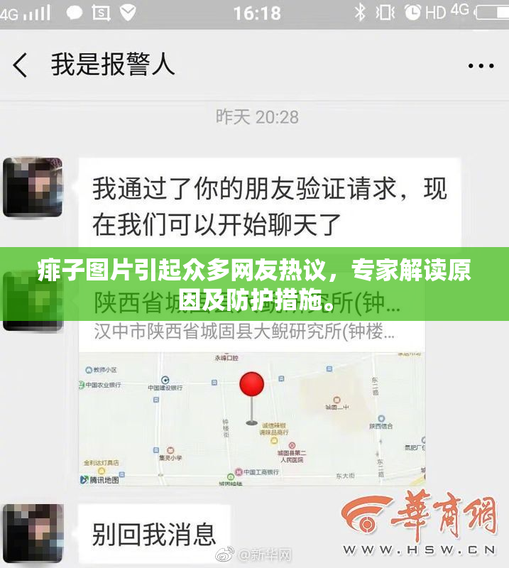 痱子图片引起众多网友热议，专家解读原因及防护措施。