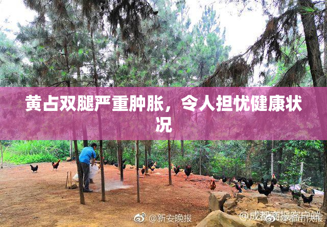 黄占双腿严重肿胀，令人担忧健康状况