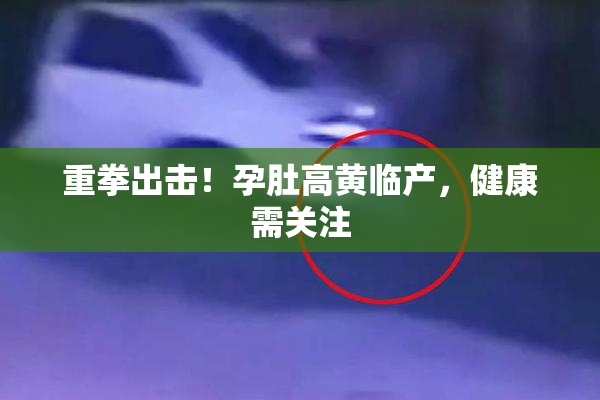 重拳出击！孕肚高黄临产，健康需关注