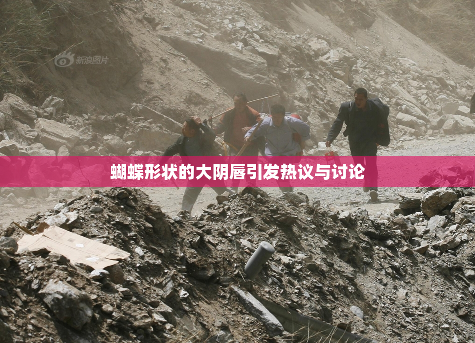 蝴蝶形状的大阴唇引发热议与讨论