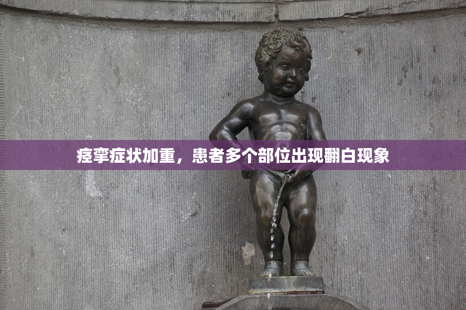 痉挛症状加重，患者多个部位出现翻白现象