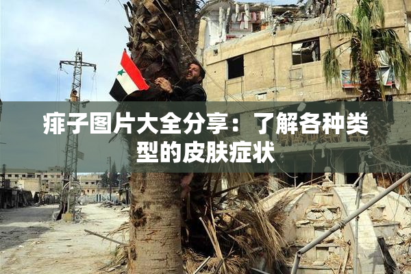 痱子图片大全分享：了解各种类型的皮肤症状